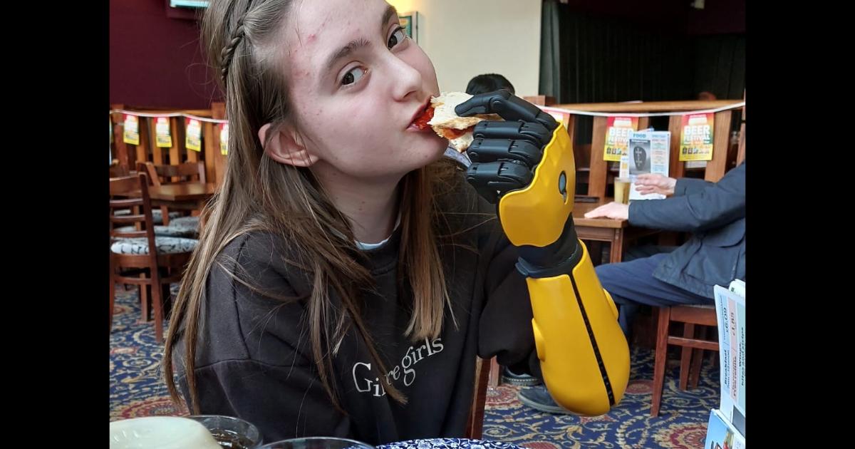 Teenager from Pocklington receives 'life-changing' Hero Arm