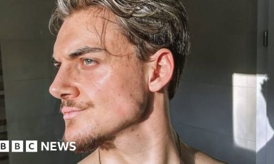 Inside the world of looksmaxxing