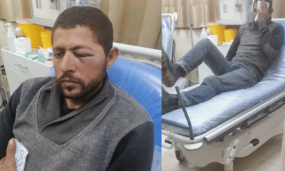 Two photos side by side: a Palestinian man in hospital whose left eye is swollen shit and another photo of him in bed holding what appears to be an ice pack over his eye