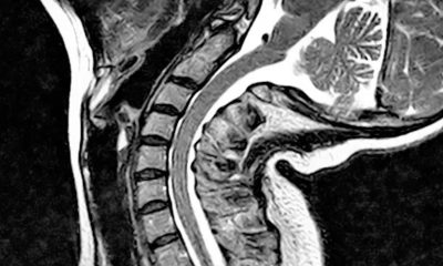 EDS set to be the subject of a UK parliament debate