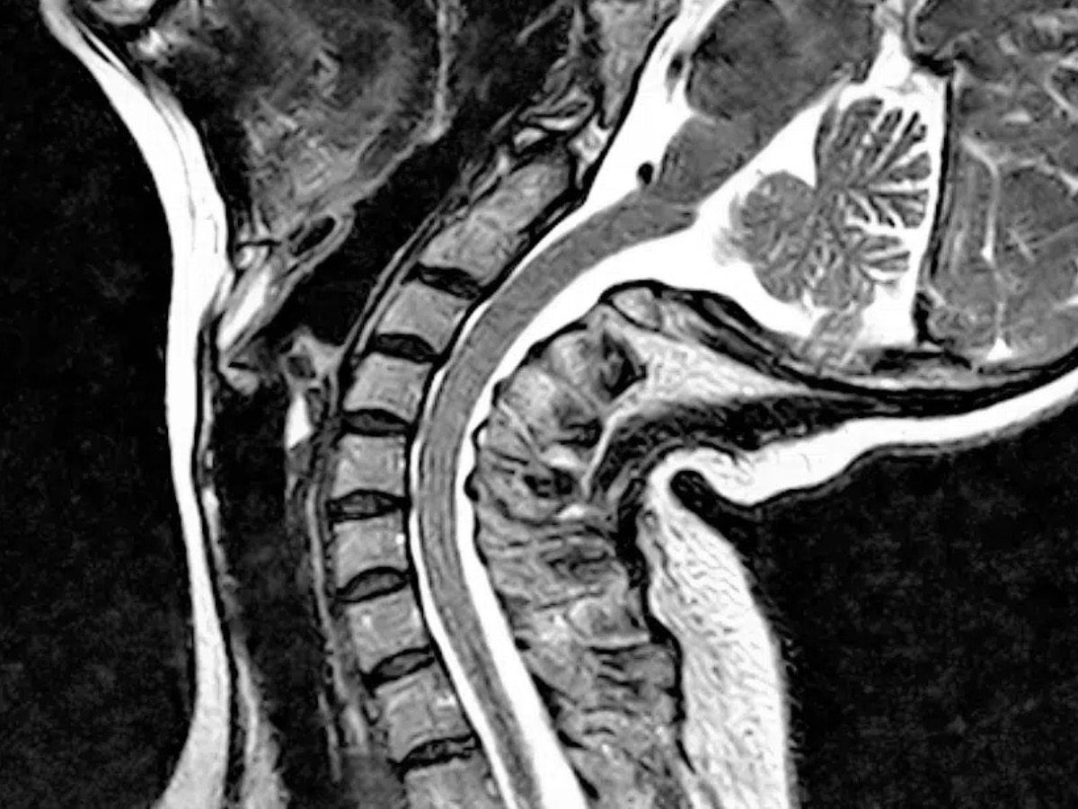 EDS set to be the subject of a UK parliament debate