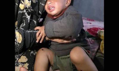 Israeli military tortured Palestinian baby