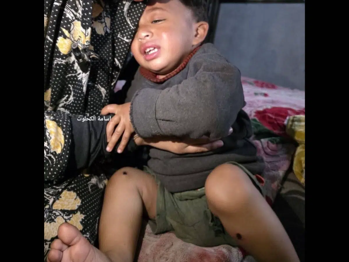 Israeli military tortured Palestinian baby