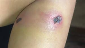 Israel tortured a baby and could have disappeared his father