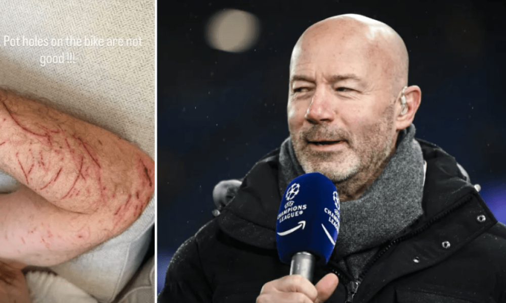 Premier League legend Alan Shearer suffers nasty injuries in bike crash | Football