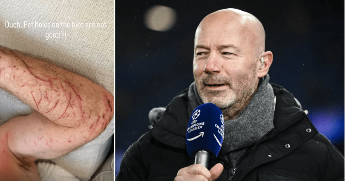 Premier League legend Alan Shearer suffers nasty injuries in bike crash | Football