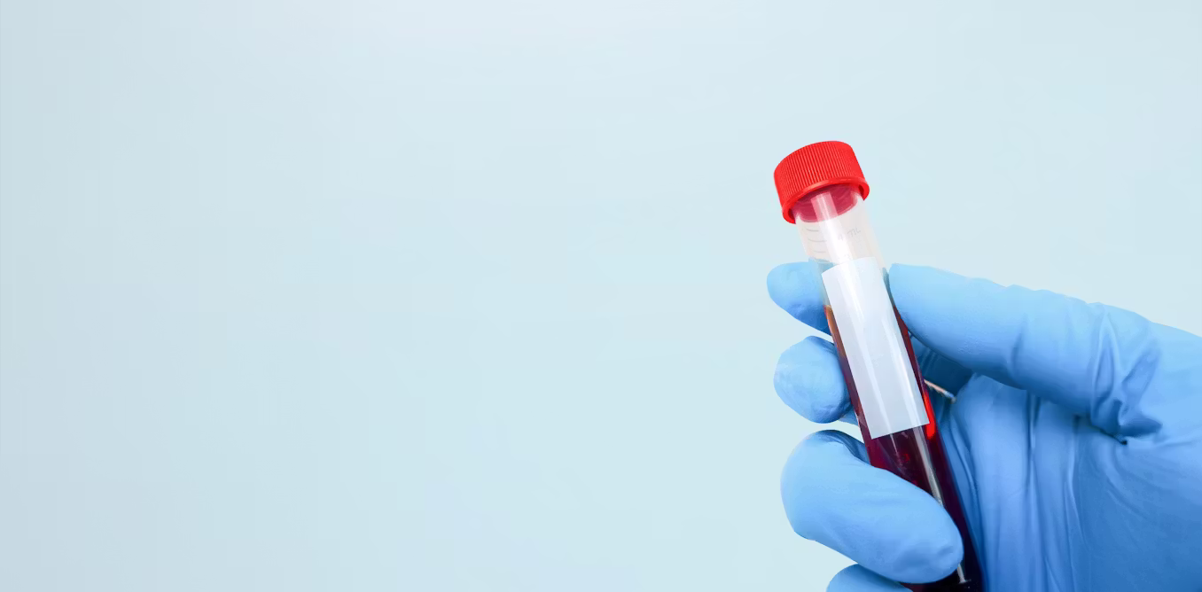 Blood tests for cancer? We’re still a way off