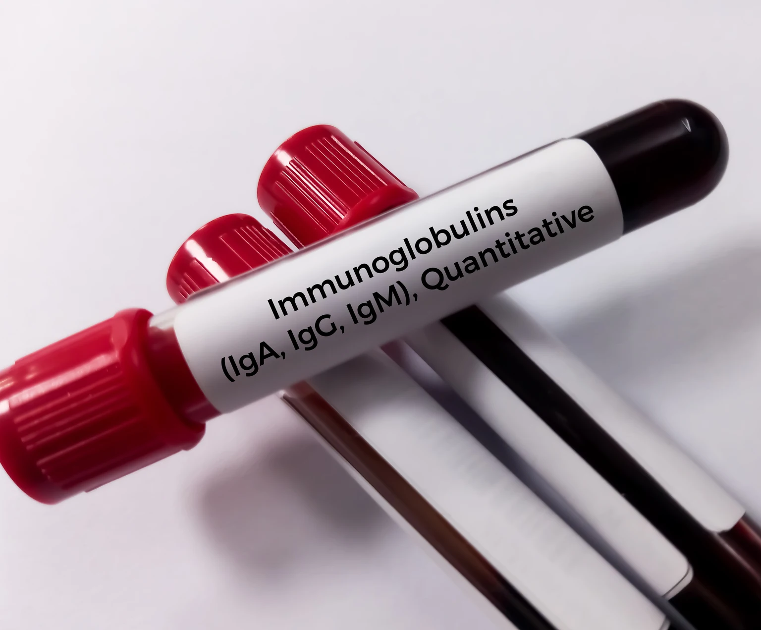 ADMA Biologics: Differentiated Plasma Approach With Asymmetric Upside Potential (Upgrade)