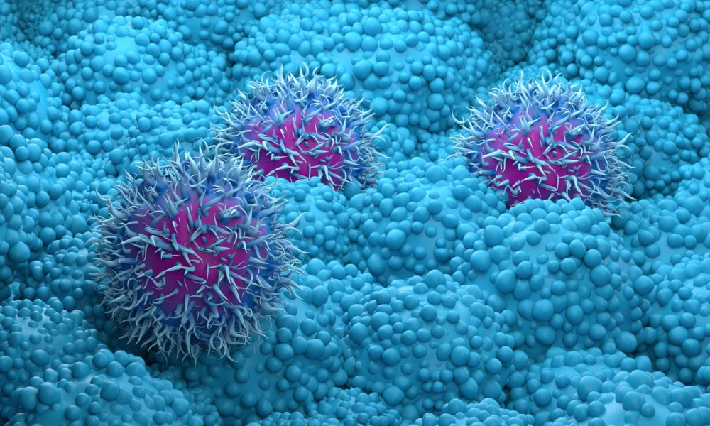 Pancreatic cancer drug daraxonrasib from Revolution Medicines succeeds in trial