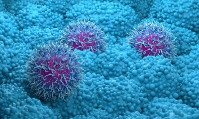 Pancreatic cancer drug daraxonrasib from Revolution Medicines succeeds in trial