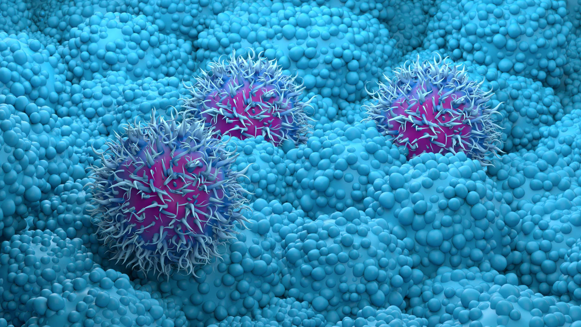 Pancreatic cancer drug daraxonrasib from Revolution Medicines succeeds in trial