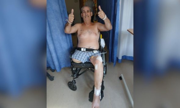 Stockton grandad lost leg after forklift ran over him at work