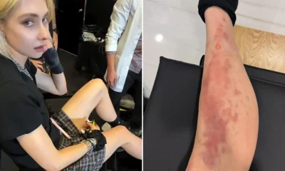 Taylor Momsen rushed to hospital after being bitten by venomous spider