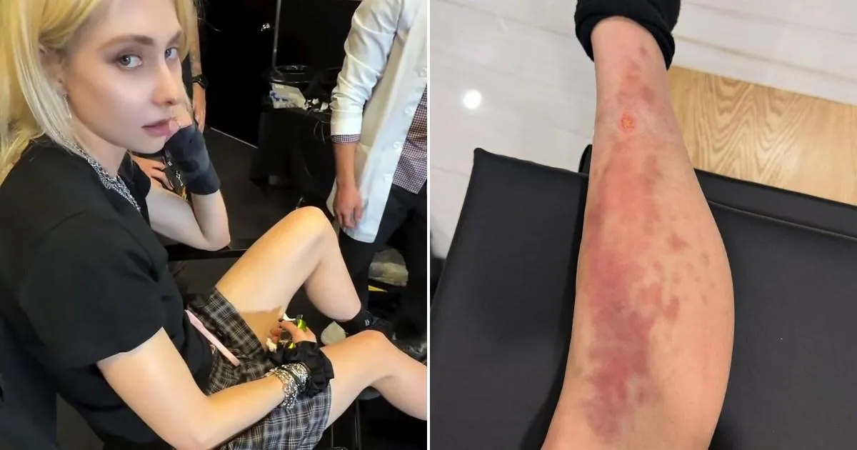 Taylor Momsen rushed to hospital after being bitten by venomous spider