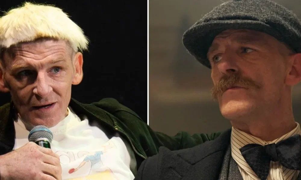 Peaky Blinders star reveals radical new look and cuts on legs