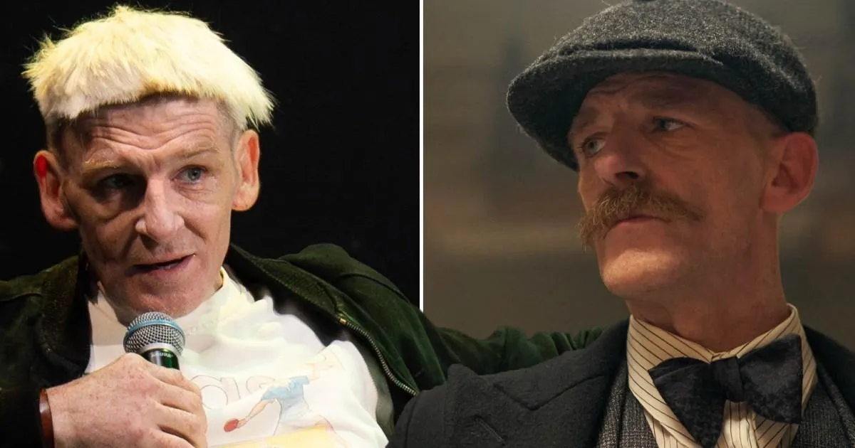 Peaky Blinders star reveals radical new look and cuts on legs