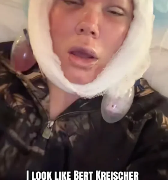 Jelly Roll's Wife Bunnie Xo Reveals Brutal Facelift Recovery