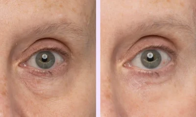 Under Eye Bags? This $30 Eye Gel Visibly Depuffs in 5 Minutes