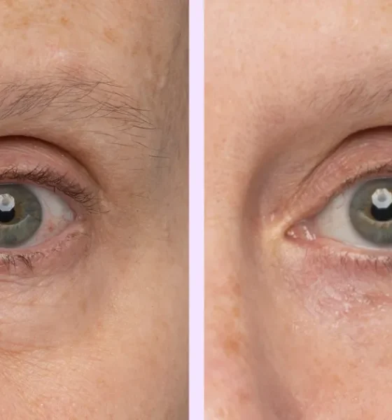 Under Eye Bags? This $30 Eye Gel Visibly Depuffs in 5 Minutes