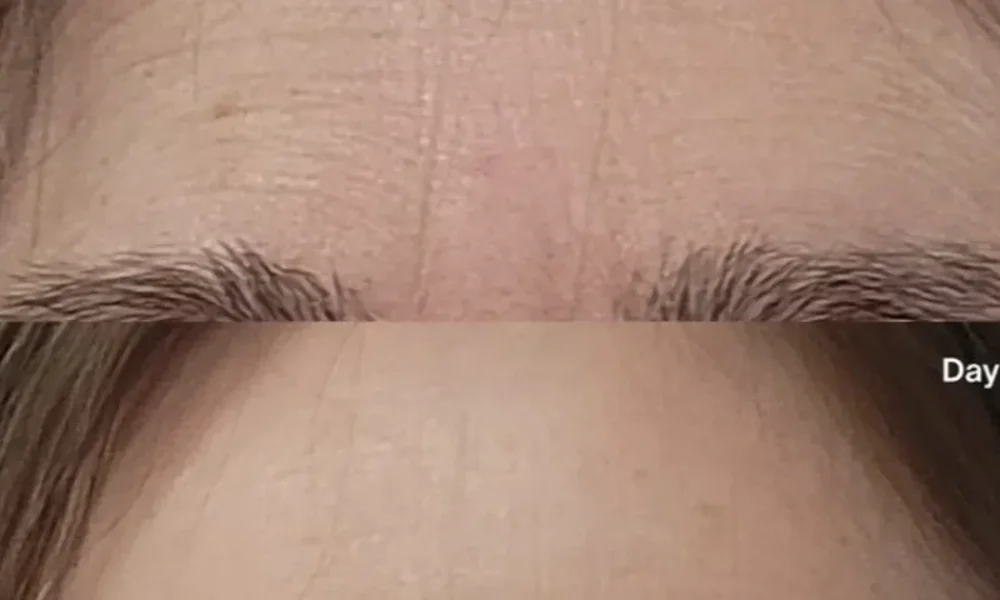 Wrinkles Between Your Brows? This 3-Minute Fix Takes Years Off