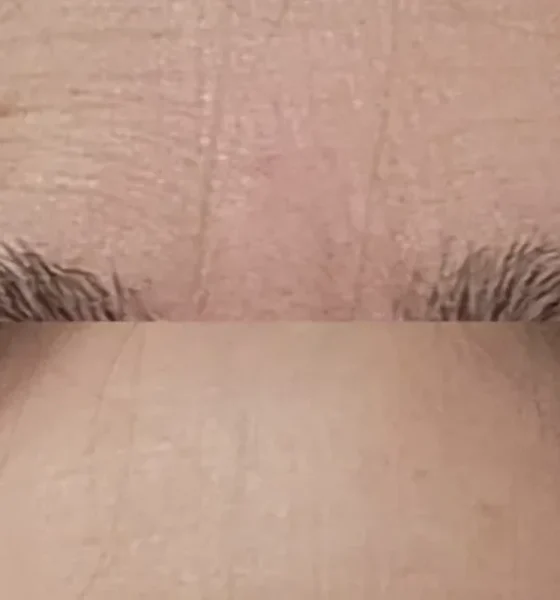 Wrinkles Between Your Brows? This 3-Minute Fix Takes Years Off