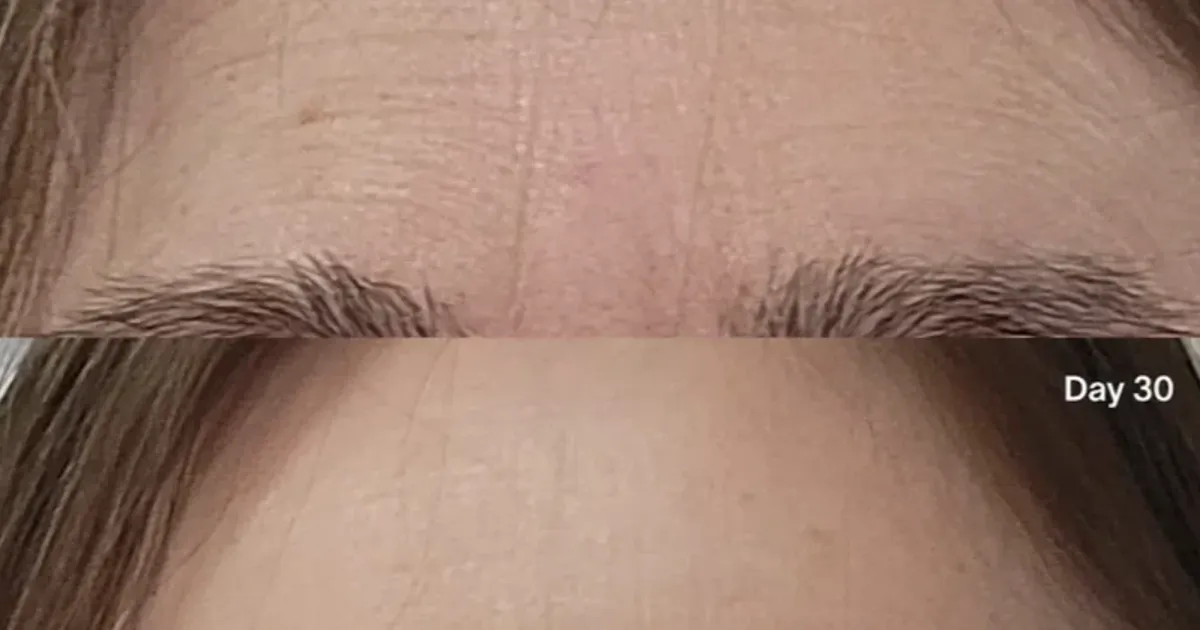 Wrinkles Between Your Brows? This 3-Minute Fix Takes Years Off