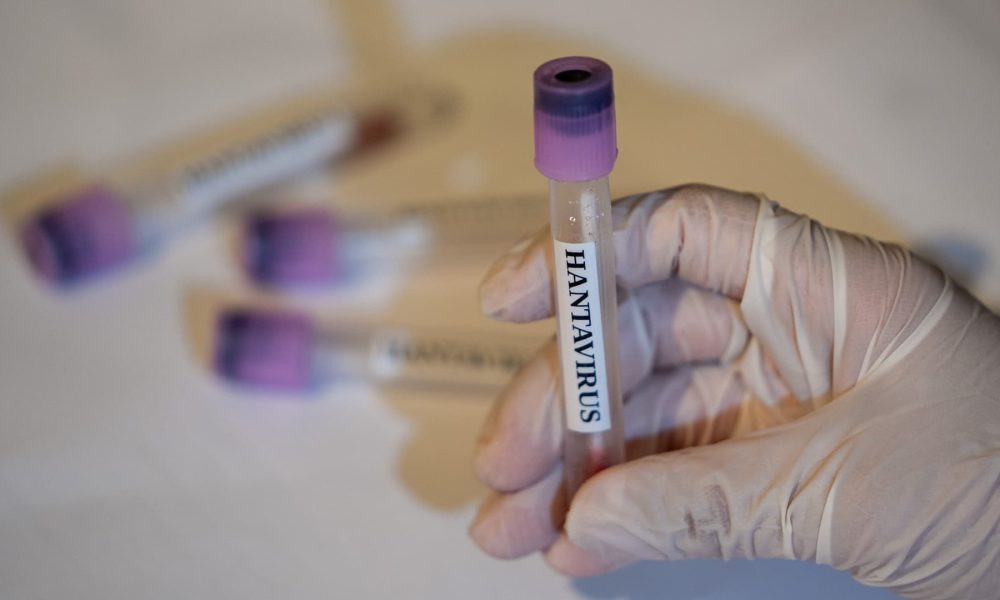 CDC says there are no U.S. hantavirus cases currently, 41 people being monitored