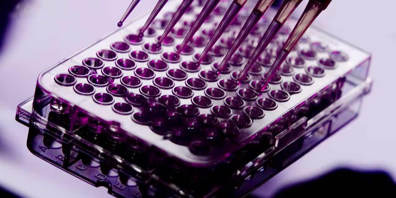 Sarepta Stock Slumps. Why an Earnings Beat Wasn’t Enough for the S&P 500 Loser.