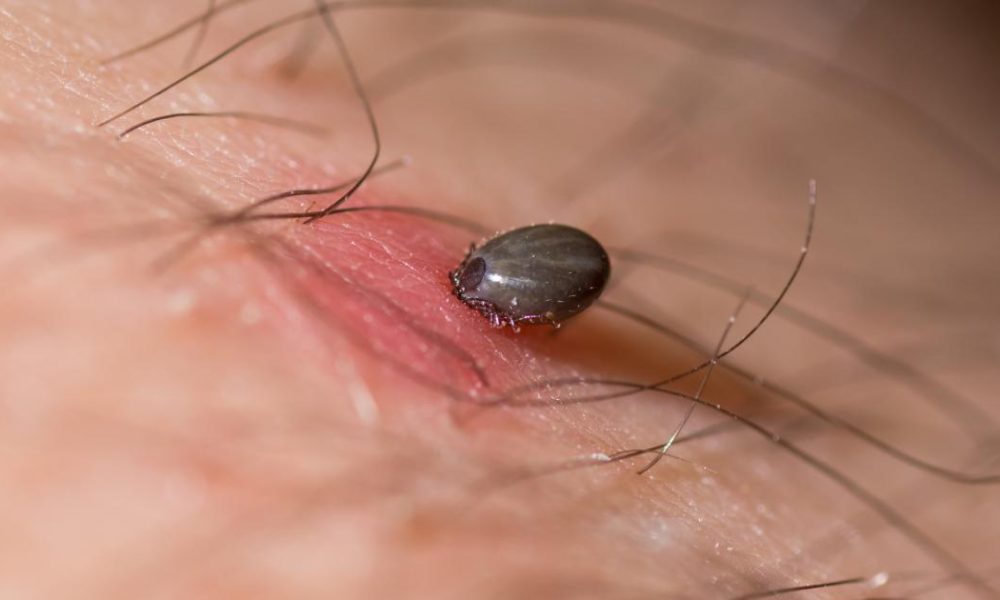 UK Health Security Agency issue tick advice to Brits