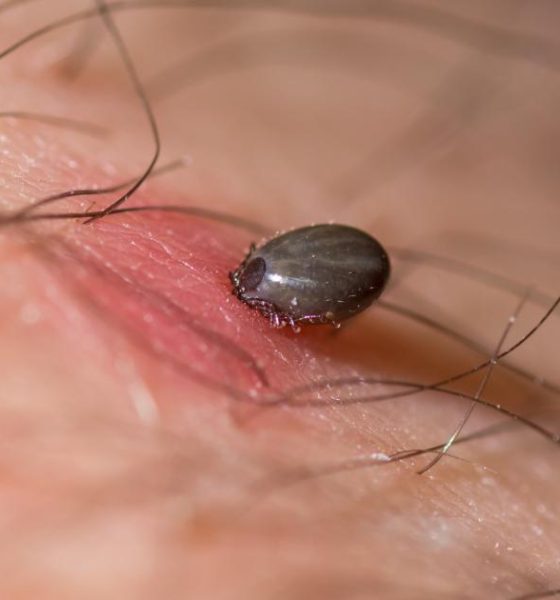 UK Health Security Agency issue tick advice to Brits