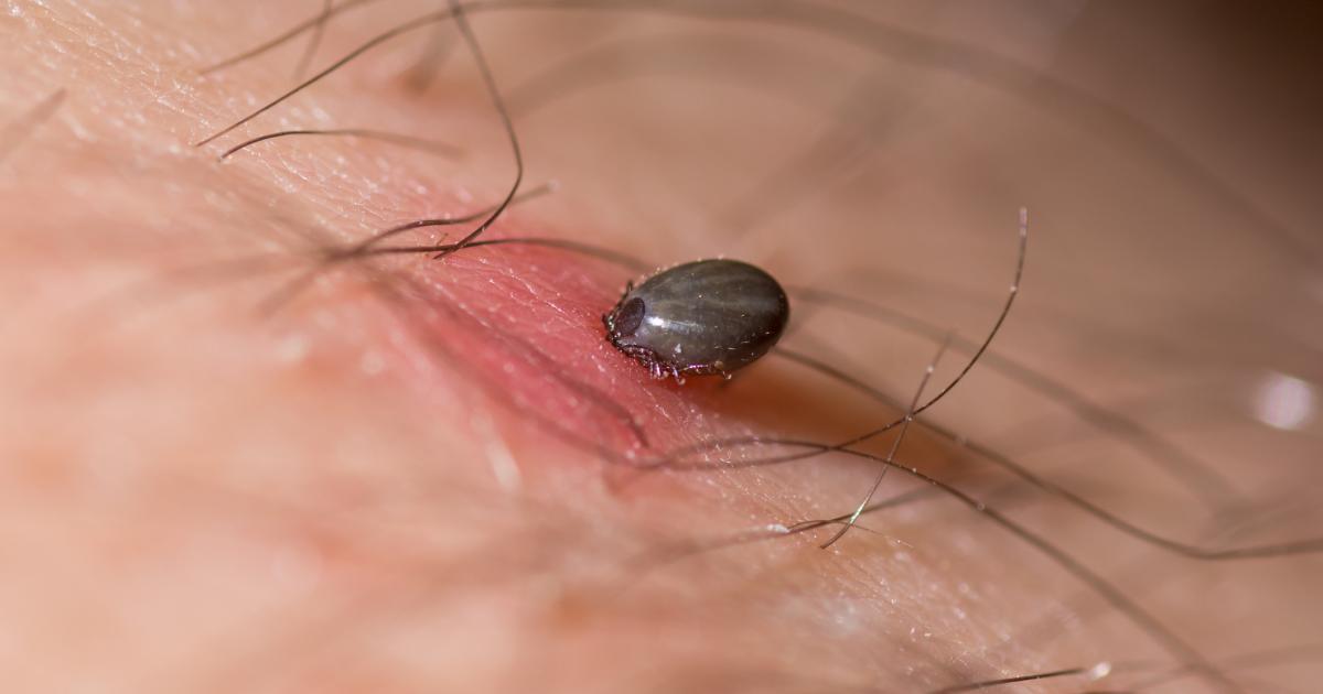 UK Health Security Agency issue tick advice to Brits
