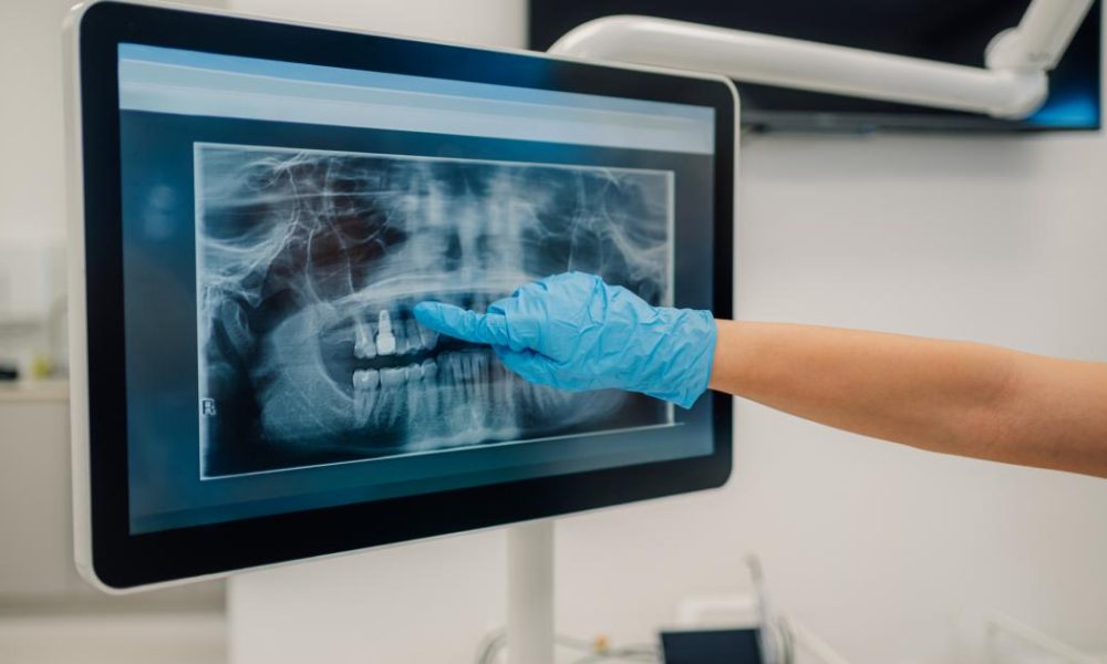 Dentist names common bad habit that can 'make us look older'