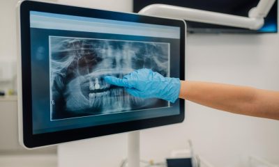 Dentist names common bad habit that can 'make us look older'