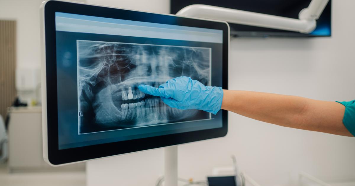 Dentist names common bad habit that can 'make us look older'