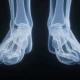 The Best Exercise For Stronger Shins And Calves