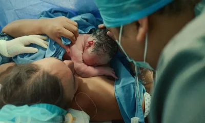 Obstetrician Reveals What Happens Behind The Curtain During A C-Section Birth