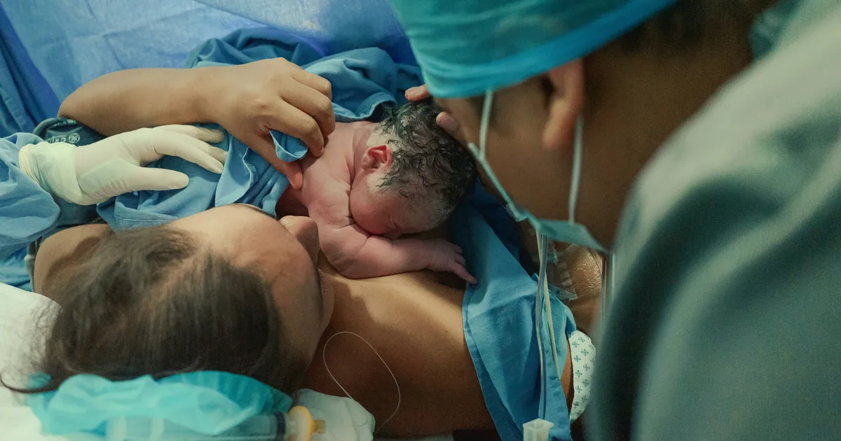 Obstetrician Reveals What Happens Behind The Curtain During A C-Section Birth