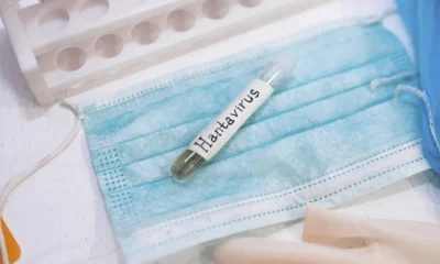 Is Hantavirus a new STI? Here's why it could be in your semen