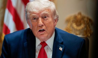 Trump in excellent health with leg swelling, hand bruising, doctor says