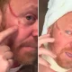Leigh Francis reveals horrifyingly huge gash on face caused by fan's fingernail