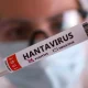 Could deadly hantavirus become the next global pandemic? | News World