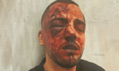 Saleh Khalil Faisal Na’ama in Israel. His face is red with darkened blood and his right eye swollen shut