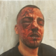 Saleh Khalil Faisal Na’ama in Israel. His face is red with darkened blood and his right eye swollen shut