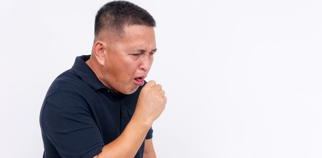 The ‘100-day cough’ that adults often miss