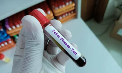 Forte Biosciences: Targeting Celiac Disease