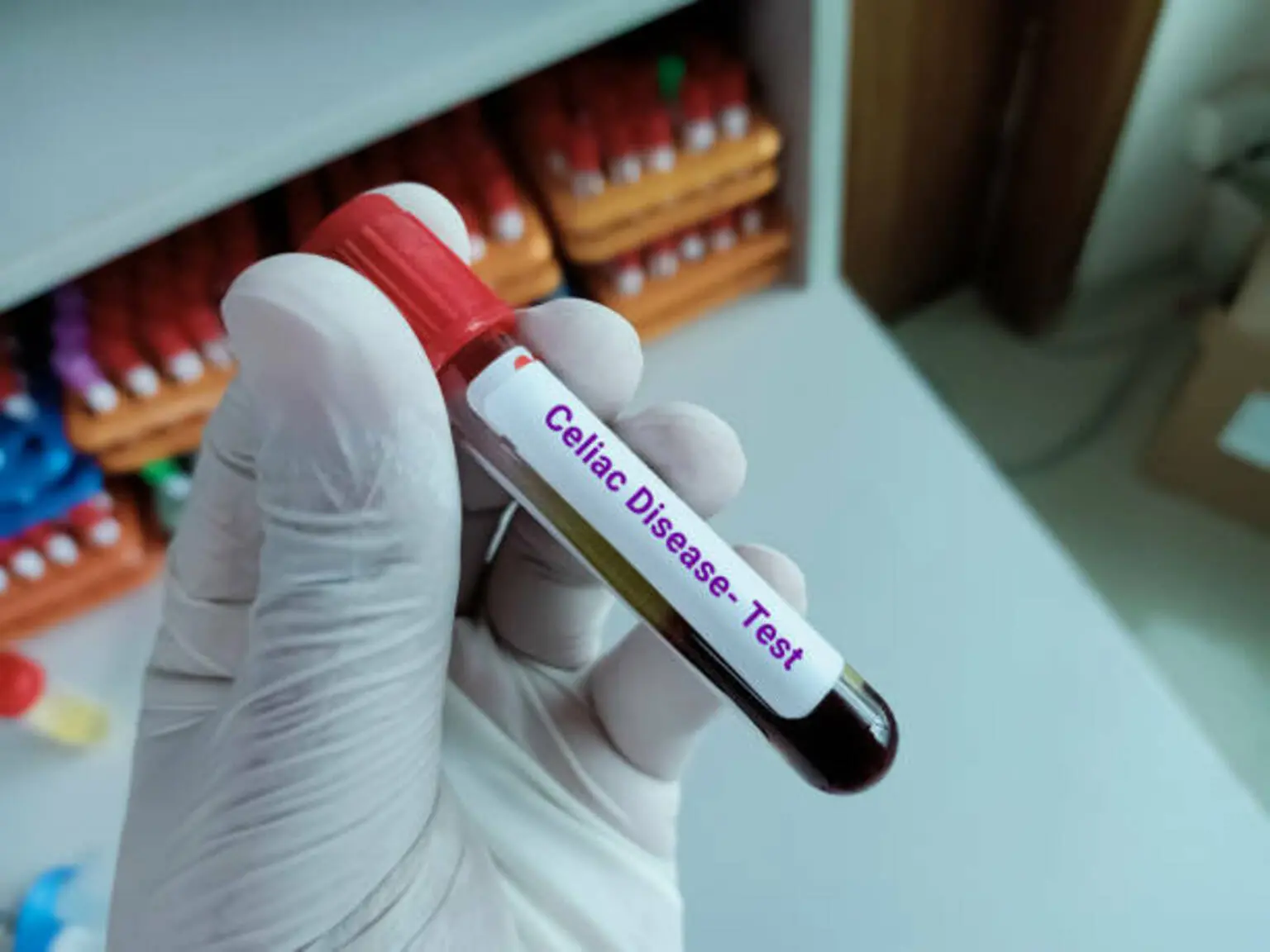 Forte Biosciences: Targeting Celiac Disease