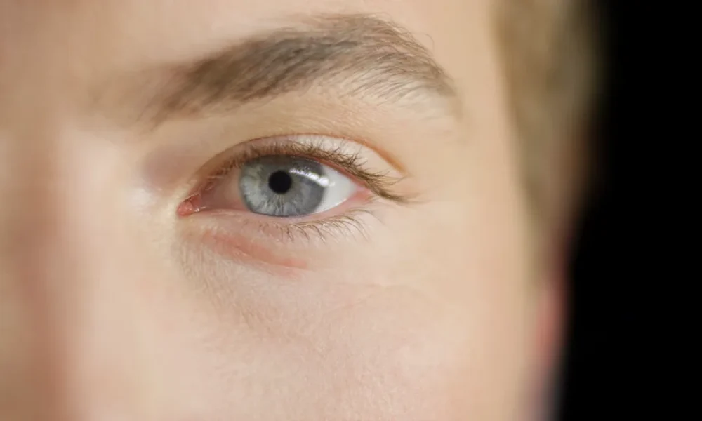 Got Grey Eyes? TikTok Doctor Explains How You Are Special