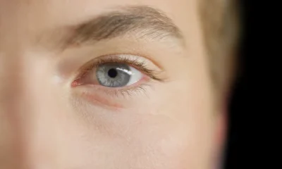 Got Grey Eyes? TikTok Doctor Explains How You Are Special
