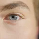 Got Grey Eyes? TikTok Doctor Explains How You Are Special
