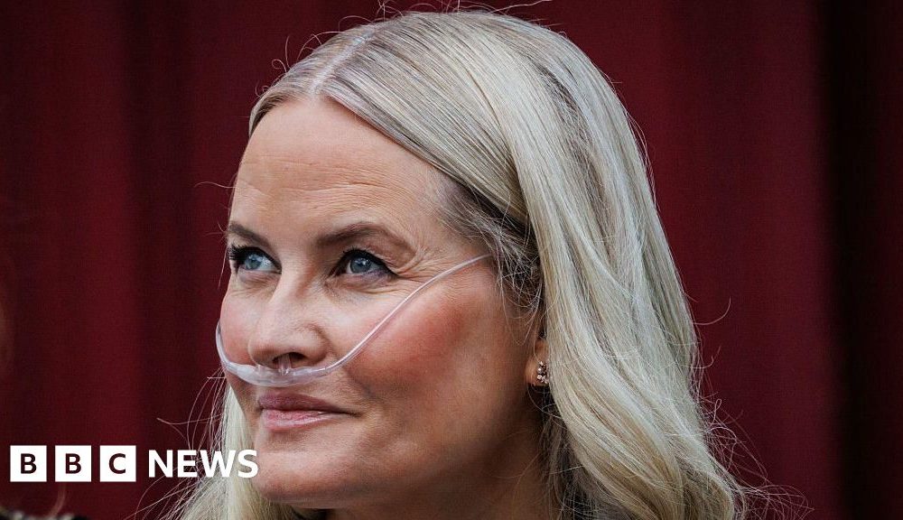Norway's crown princess undergoes successful lung transplant, palace says